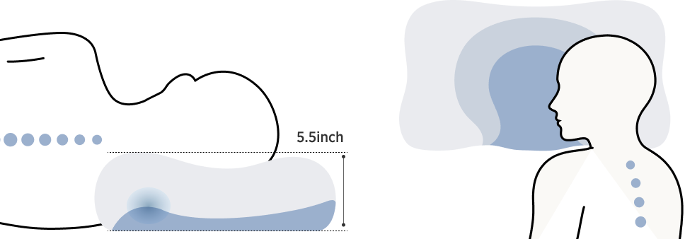 Bedsure