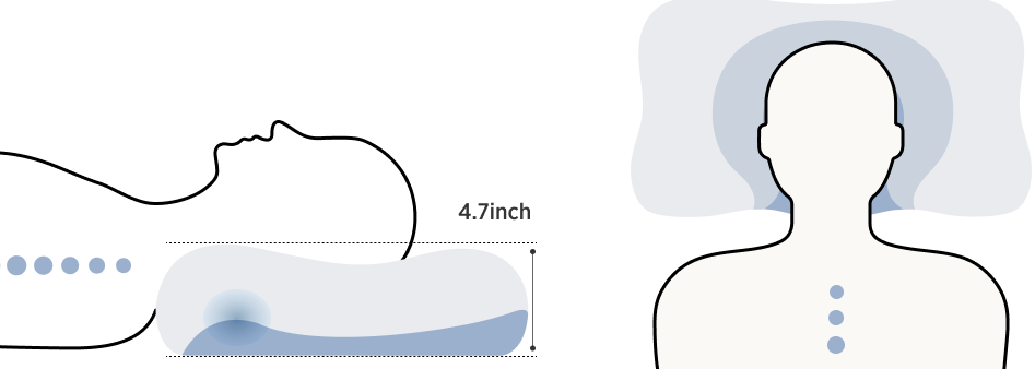 Bedsure